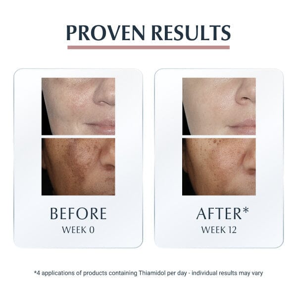 Eucerin Anti-Pigment Dual Serum 30 ml Eucerin