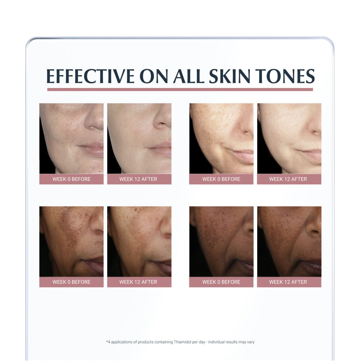 Eucerin Anti-Pigment Spot Corrector 5 ml Eucerin
